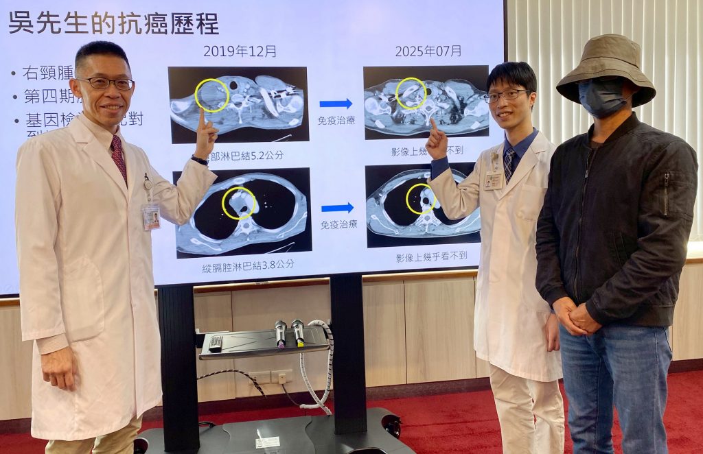 右鎖骨旁硬塊 男肺腺癌轉移腦部