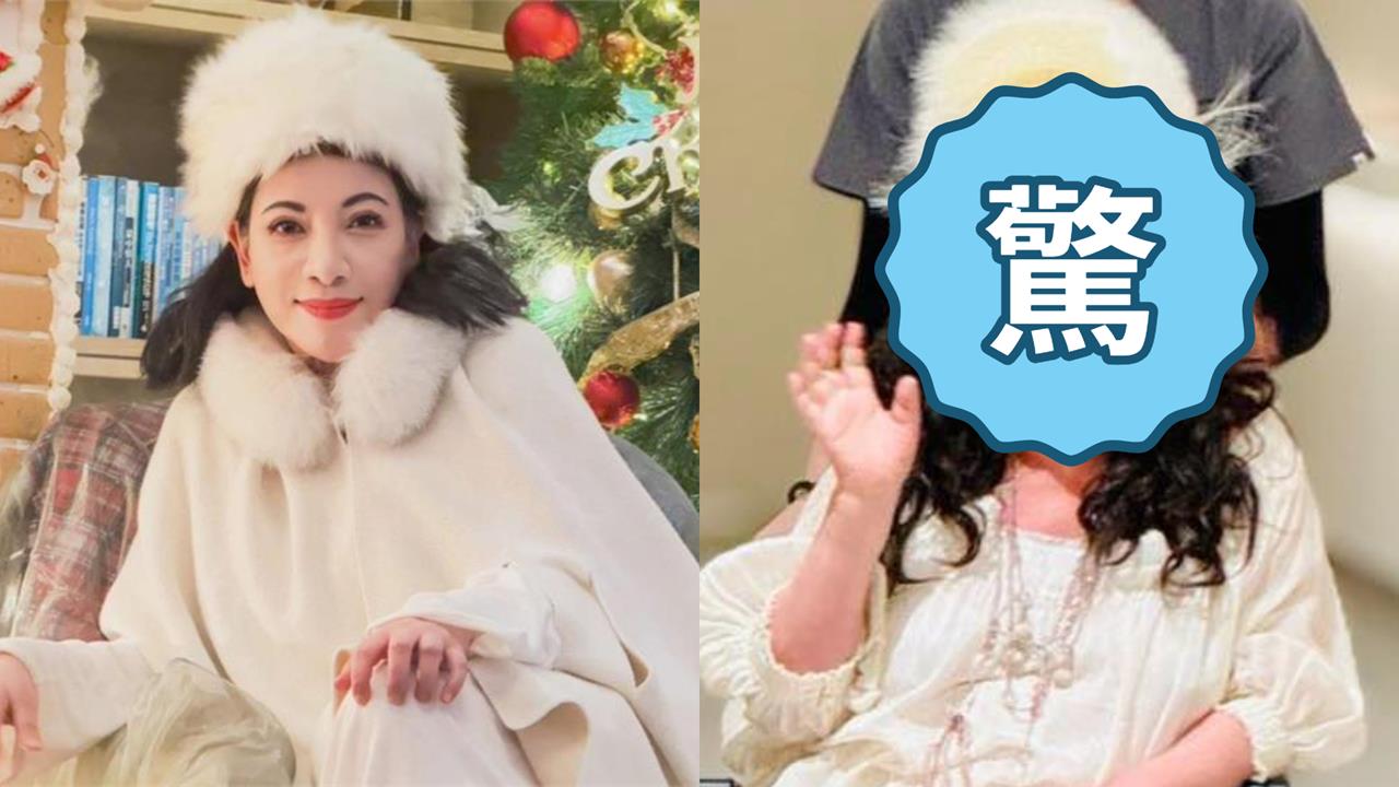 陳文茜抗癌現況曝！台大醫「坐輪椅當飛...