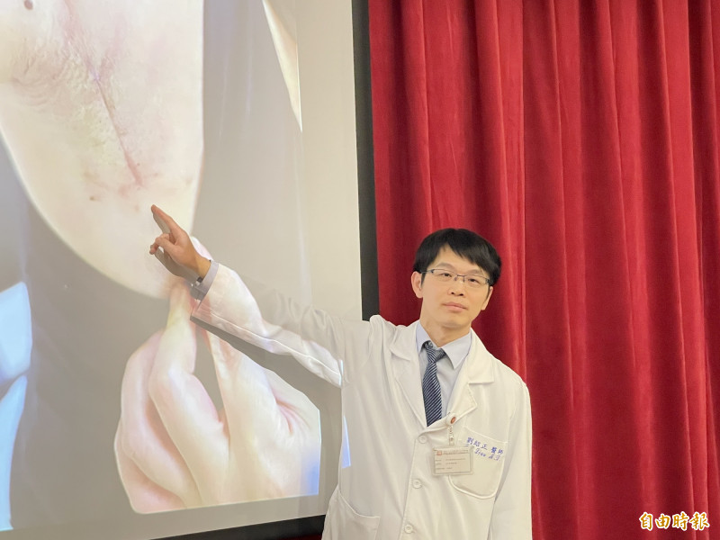 切除甲狀腺腫瘤、頸部不留疤 三總新技...